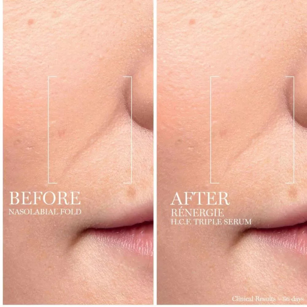Lancôme Rénergie H.C.F. Triple Serum before and after skin appearance